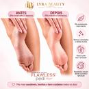 Lixador de Pé Elétrico Tira Calos e Pele Grossa – Lyra Beauty