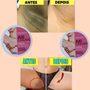Clareador e Esfoliante de Axilas e Virilha AxiCrean Euroderm 150 g