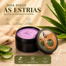 Creme Corporal Hidratante para Pele com Estrias 150g - L&Beauty