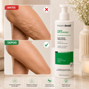Kit Creme Anti Estrias + Anti Flacidez -- Mais Firmeza, Elasticidade e Pele Renovada