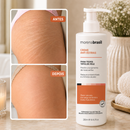 Kit Creme Anti Estrias + Anti Flacidez -- Mais Firmeza, Elasticidade e Pele Renovada