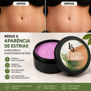 Creme Corporal Hidratante para Pele com Estrias 150g - L&Beauty