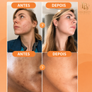 Skincare Vitamina C - 5 itens em um único kit - Lyra Beauty